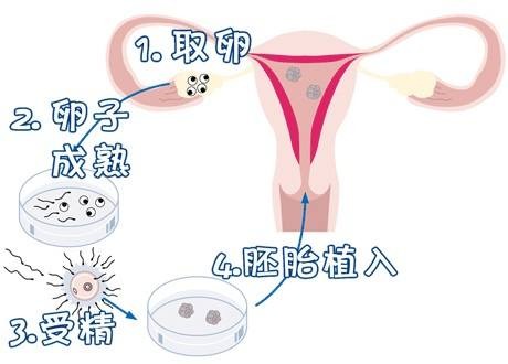 专业同志代怀服务收费标准